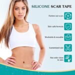 Emibele Silicone Scar Sheets (1.6"x 120"Roll-3M), Silicone Scar Tape, Professional Scar Gel Reusable Scar Roll, Soft Breathable Scar Removal Strip for Keloid,Acne,C-Section,Surgery,Burn Scar,Trauma,et - Image 3
